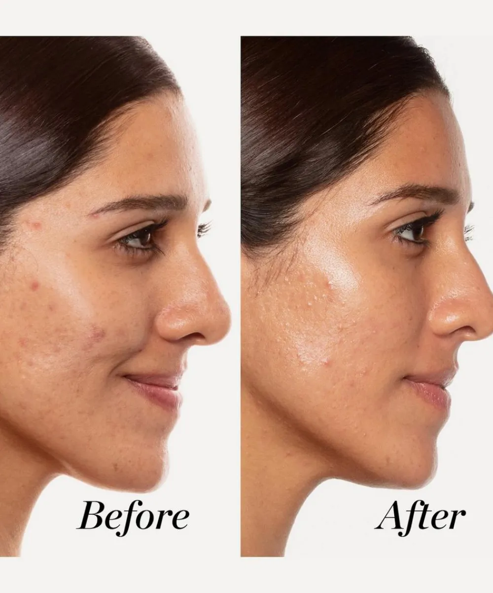 Sunday Riley Facial Serums & Oils^A+ High Dose Retinoid Serum 50ml