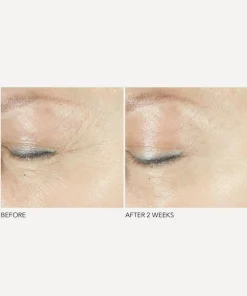 Dr. Dennis Gross Skincare Skin Concern|Facial Serums & Oils^Advanced Retinol + Ferulic Triple Correction Eye Serum 15ml