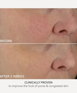 Dr. Dennis Gross Skincare Cleansers & Toners^Advanced Retinol and Ferulic Perfectly Dosed Treatment Pack of 8