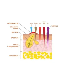 Dr. Dennis Gross Skincare Skin Concern|Tools & Accessories^DRx SpectraLite FaceWare Pro