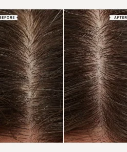 Philip Kingsley Shampoo^Flaky/Itchy Scalp Duo