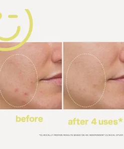 Kate Somerville Facial Serums & Oils^Mega-C 30% Vitamin C Brightening Facial 60ml