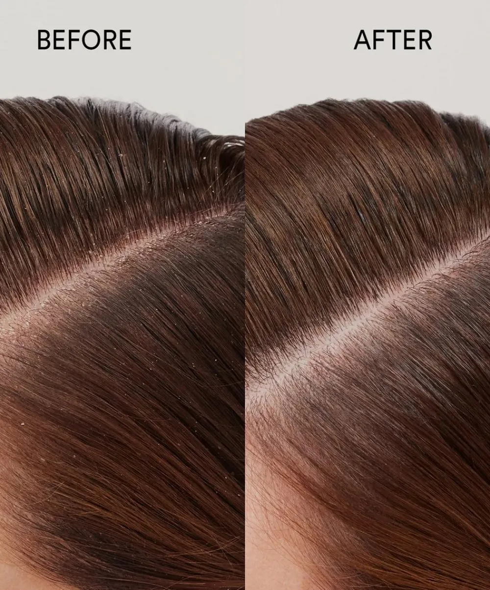 Hair by Sam McKnight Conditioner^Pure Genius Scalp Oil 30ml