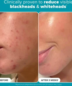 Paula's Choice Skin Concern|Masks & Exfoliators^Skin Perfecting 2% BHA Liquid Exfoliant 118ml