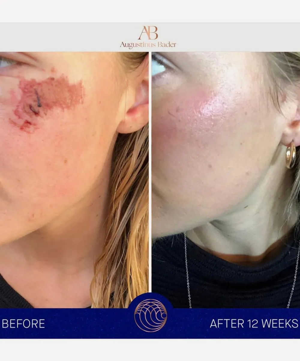 Augustinus Bader Skin Concern|Moisturisers^The Cream 30ml